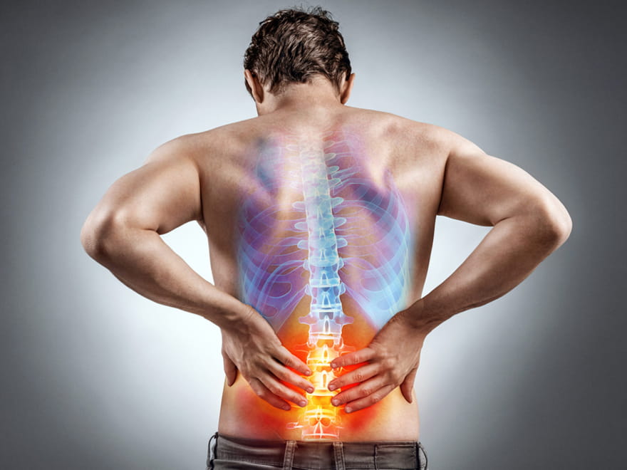 Bel Ağrısı Hakkında Doğru Bilinen Yanlışlar