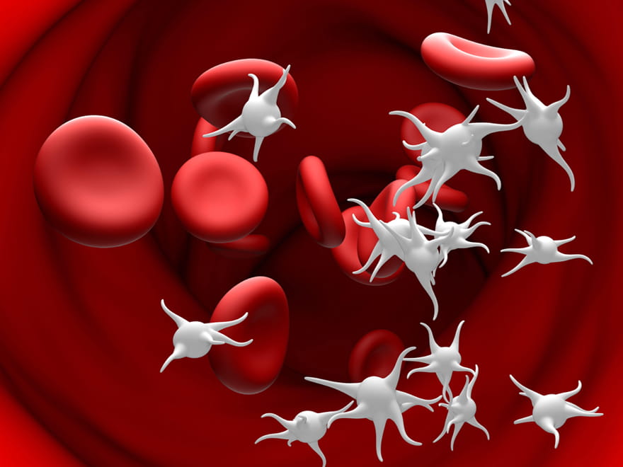 Esansiyel Trombositemi