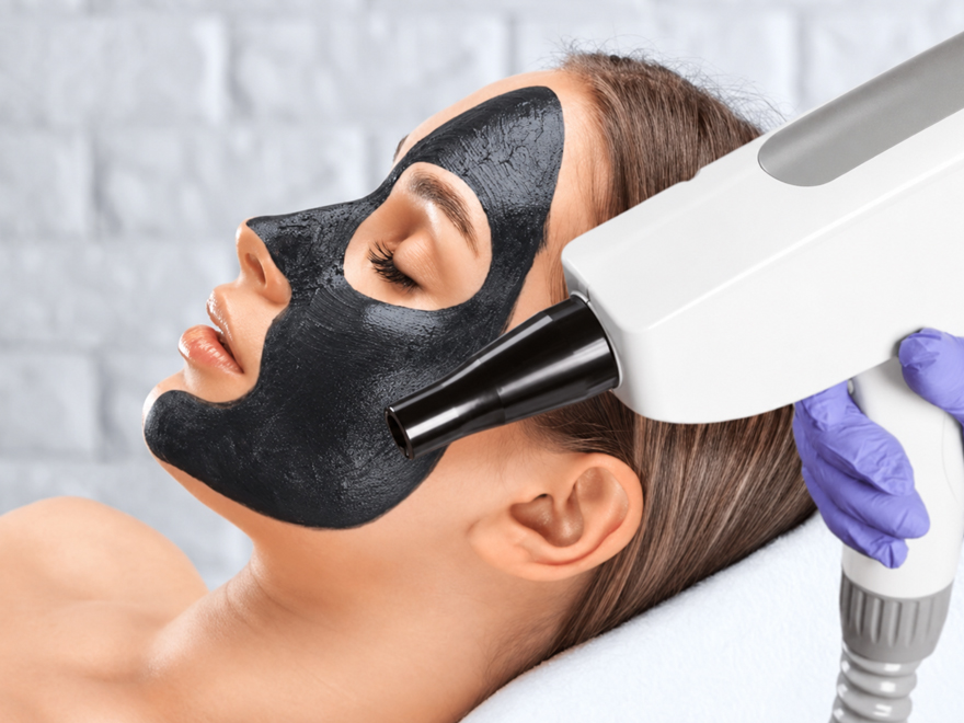 Karbon Peeling Nedir? Hangi Amaçla ve Durumlarda Kullanılır?
