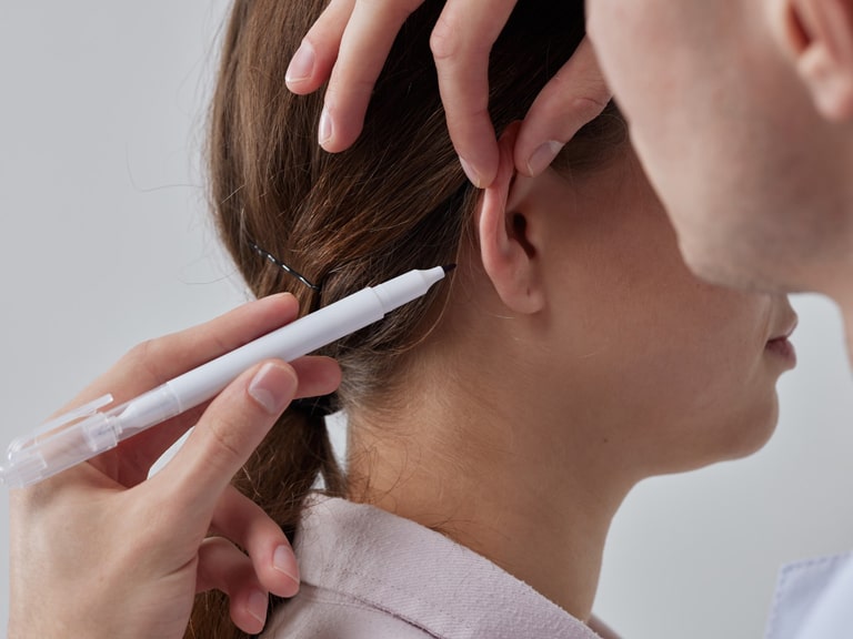 Otoplasti (Kulak Estetiği)