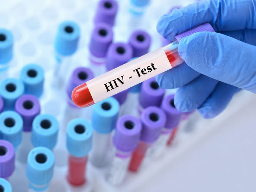 HIV Nedir? Nasıl Bulaşır?