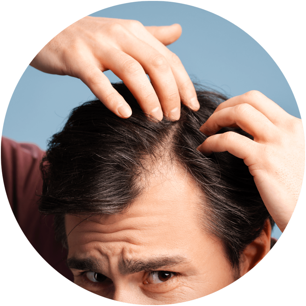 Hair Transplant Center