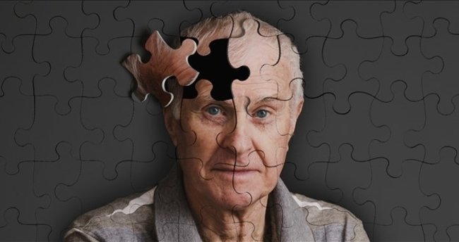 Alzheimer’s Disease Outpatient Clinic